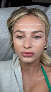 Eyebrow Lamination In Santa Monica: Why Structured, Natural Brows Are Redefining Modern Beauty